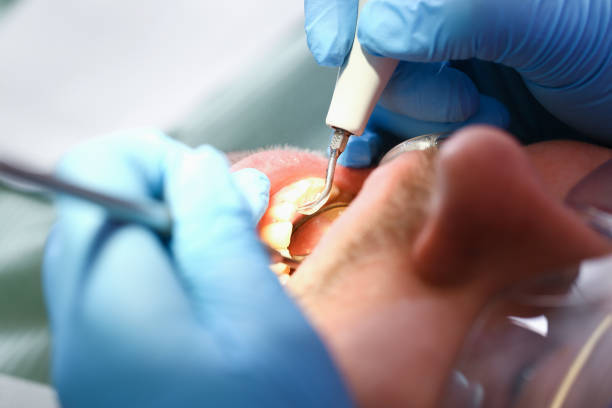 Best Emergency Treatment for Toothache in Ashley, PA
